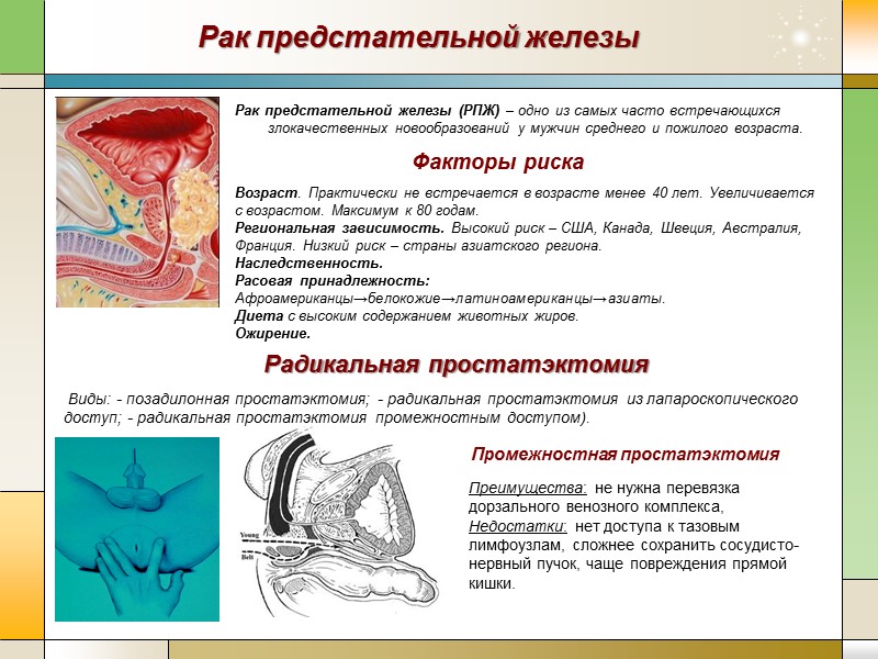 Рак предстательной железы (РПЖ) – одно из самых часто встречающихся злокачественных новообразований у мужчин
